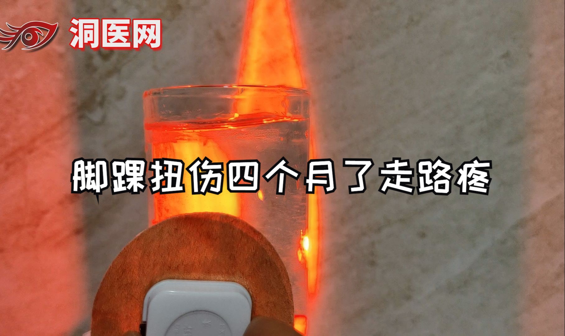 脚踝扭伤四个月了走路疼怎么回事