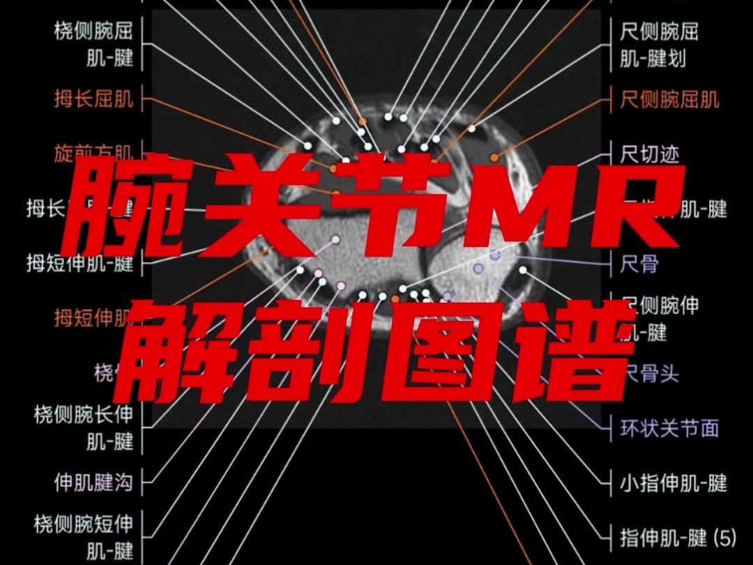 腕关节MR解剖图谱哔哩哔哩bilibili