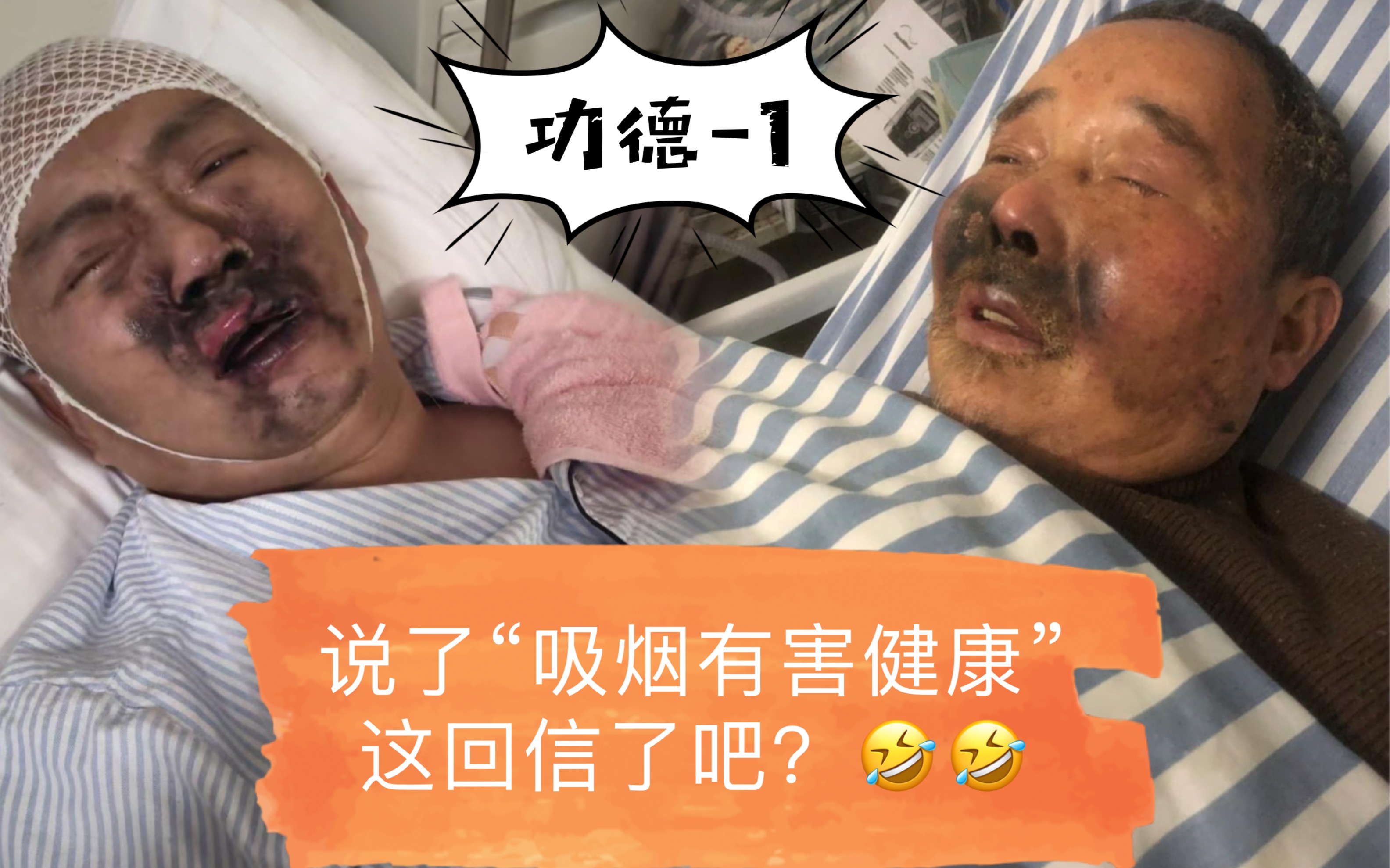 [图]说了“吸烟有害健康”这回信了吧？俩大爷 一边吸氧一边抽烟，把自己炸了