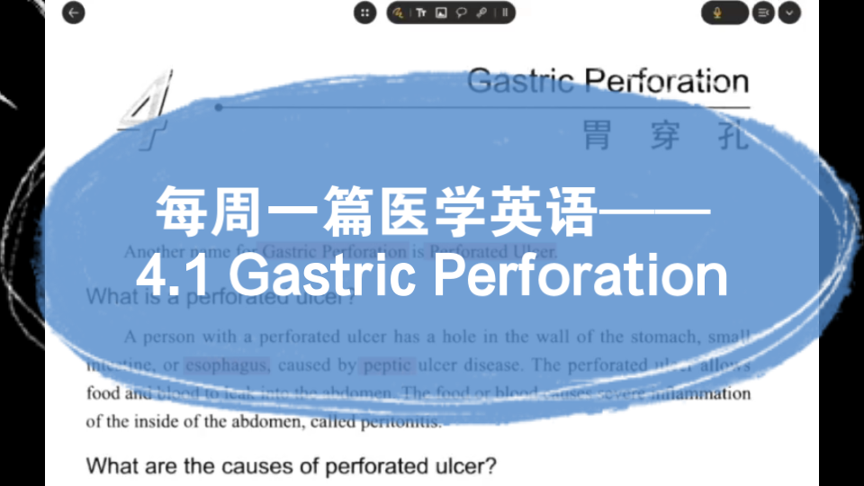 每周一篇医学英语|胃穿孔概述&病因&症状哔哩哔哩bilibili