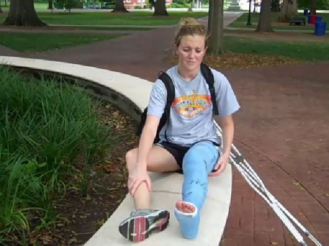 严重脚受伤的运动员小姐姐-养伤康复全过程纪录片(二)