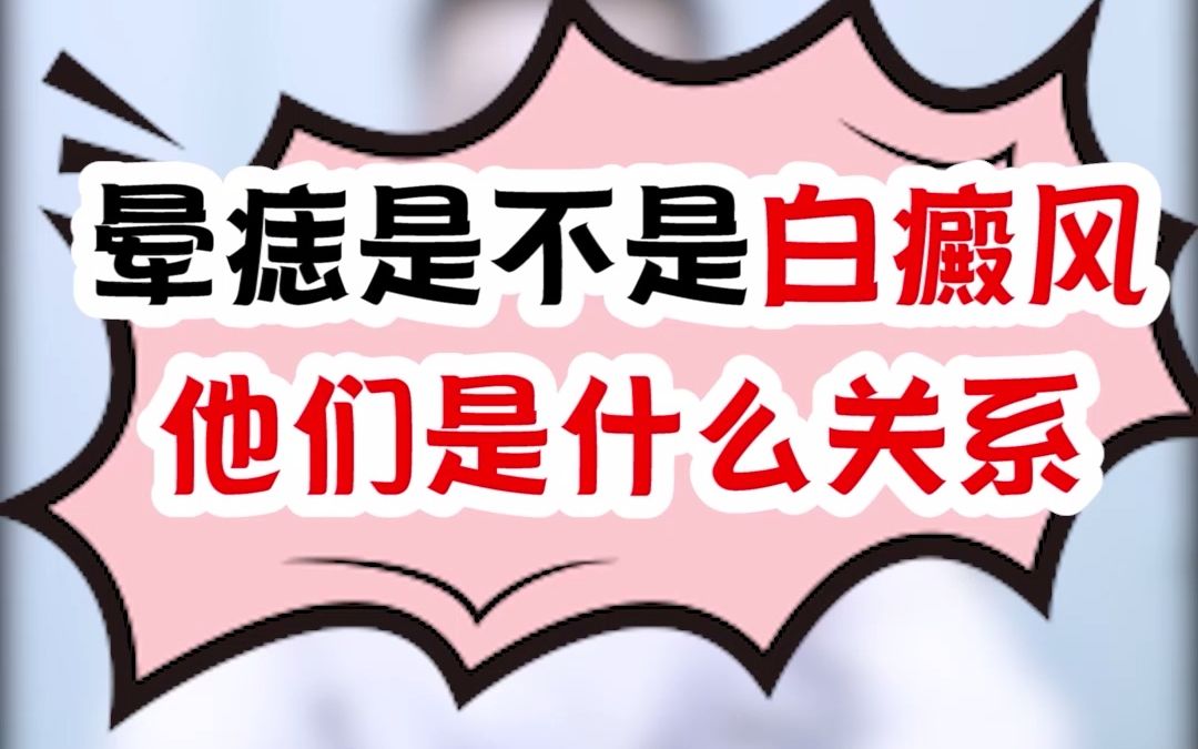 晕痣是不是白癜风
