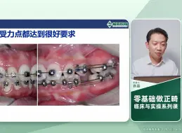 Tải video: 第一章：从云里雾里的正畸专业术语——靳磊（18节）