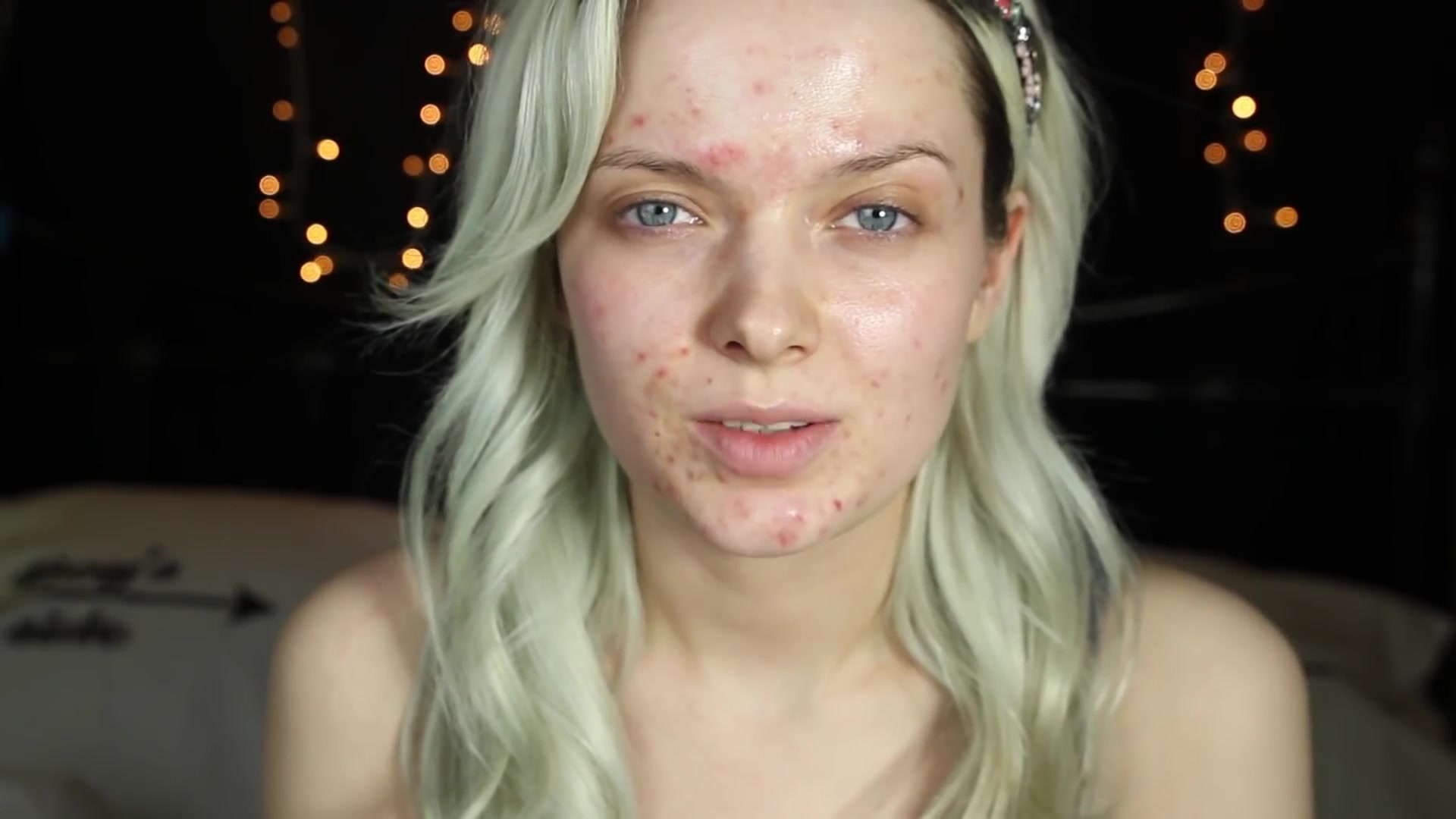 痘痘怎么遮?约会妆教程-瑕疵皮/痘痘肌博主【my pale skin】