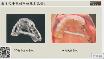 下载视频: 《静态数字化导板的临床细节及要点》