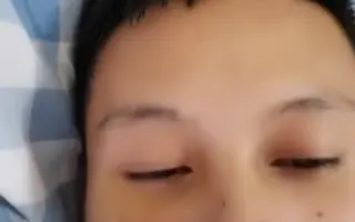 看看你们拍的视频！把俺嘴唇笑裂！到医院缝了几十针！还不能出院！手机都被收了搞笑害人搞笑短视频