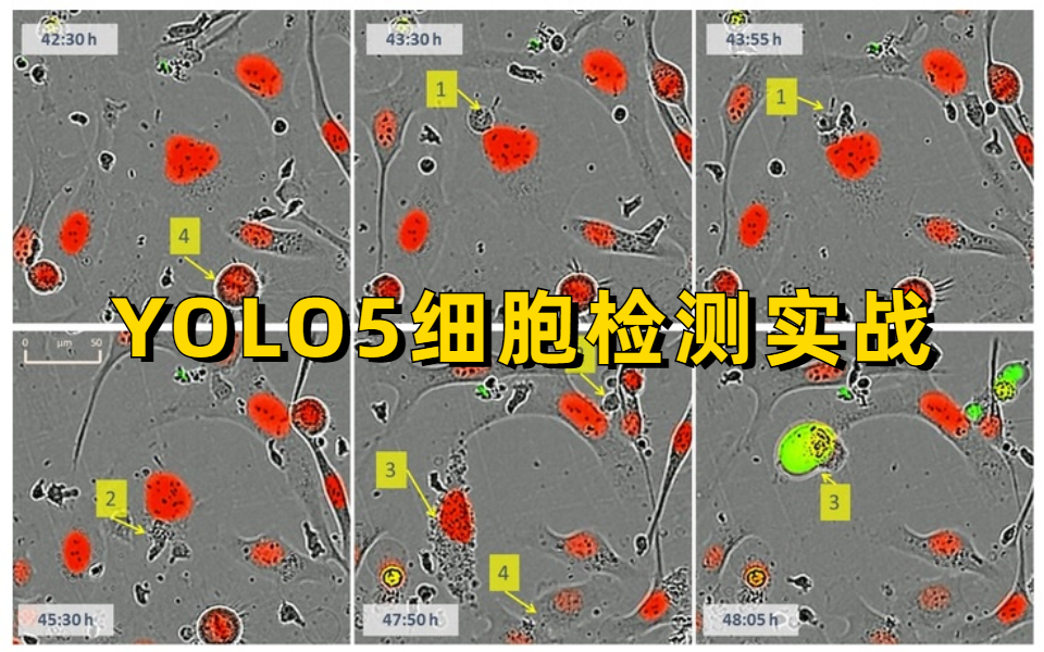 [图]【YOLO5细胞检测实战】没想到同济大学计算机博士竟然一次性讲透了YOLO系列物体检测算法-YOLO5细胞检测实战！人工智能/深度学习/机器学习