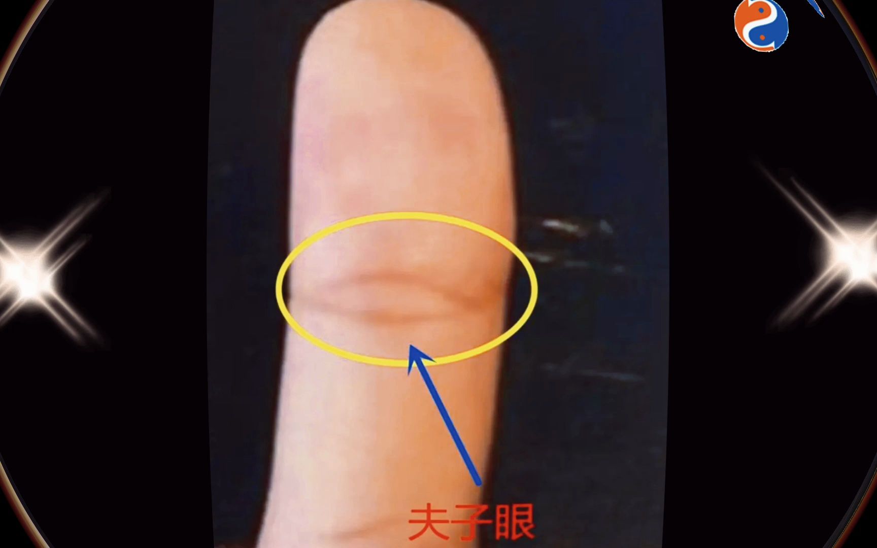 相学中少见的"夫子眼"或"凤眼"看看你手上有吗?