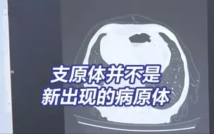 Descargar video: 今冬这波呼吸道疾病和新冠有关联吗？