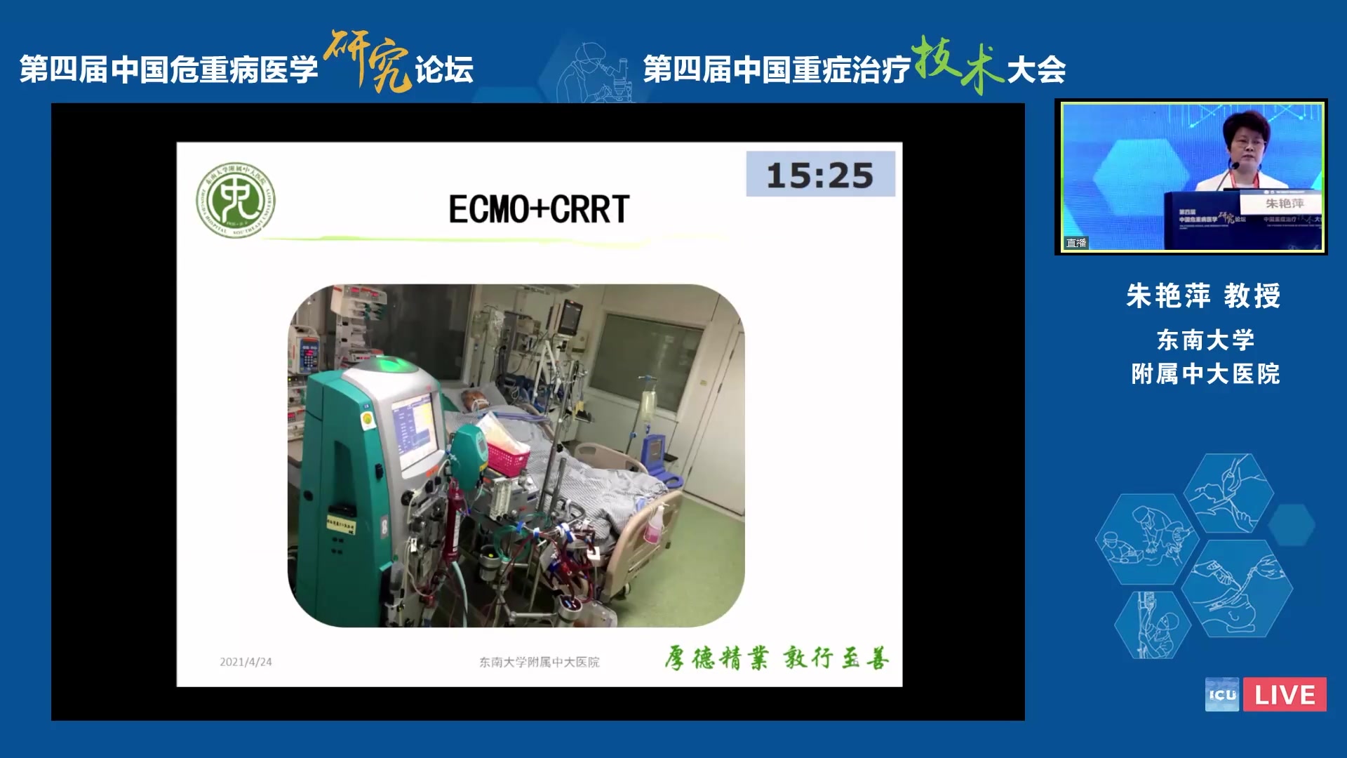 朱艳萍 ECMO护理团队的建立与管理哔哩哔哩bilibili