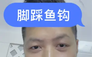 Download Video: 脚被鱼钩扎了，然而又被别人踩一脚是什么感受宝宝们