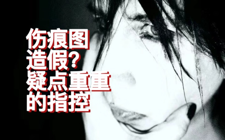 【玛丽莲曼森】伤痕图造假、“发声者”被动变为“受害者”?——玛丽莲曼森指控中的疑点哔哩哔哩bilibili