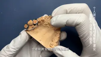 下载视频: 磨牙压低器 妃她正畸 牙齿矫正器