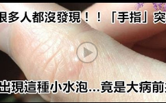 很多人都没发现!!「手指」突然出现这种小水泡…竟是大病前兆!!千万要小心了…哔哩哔哩bilibili