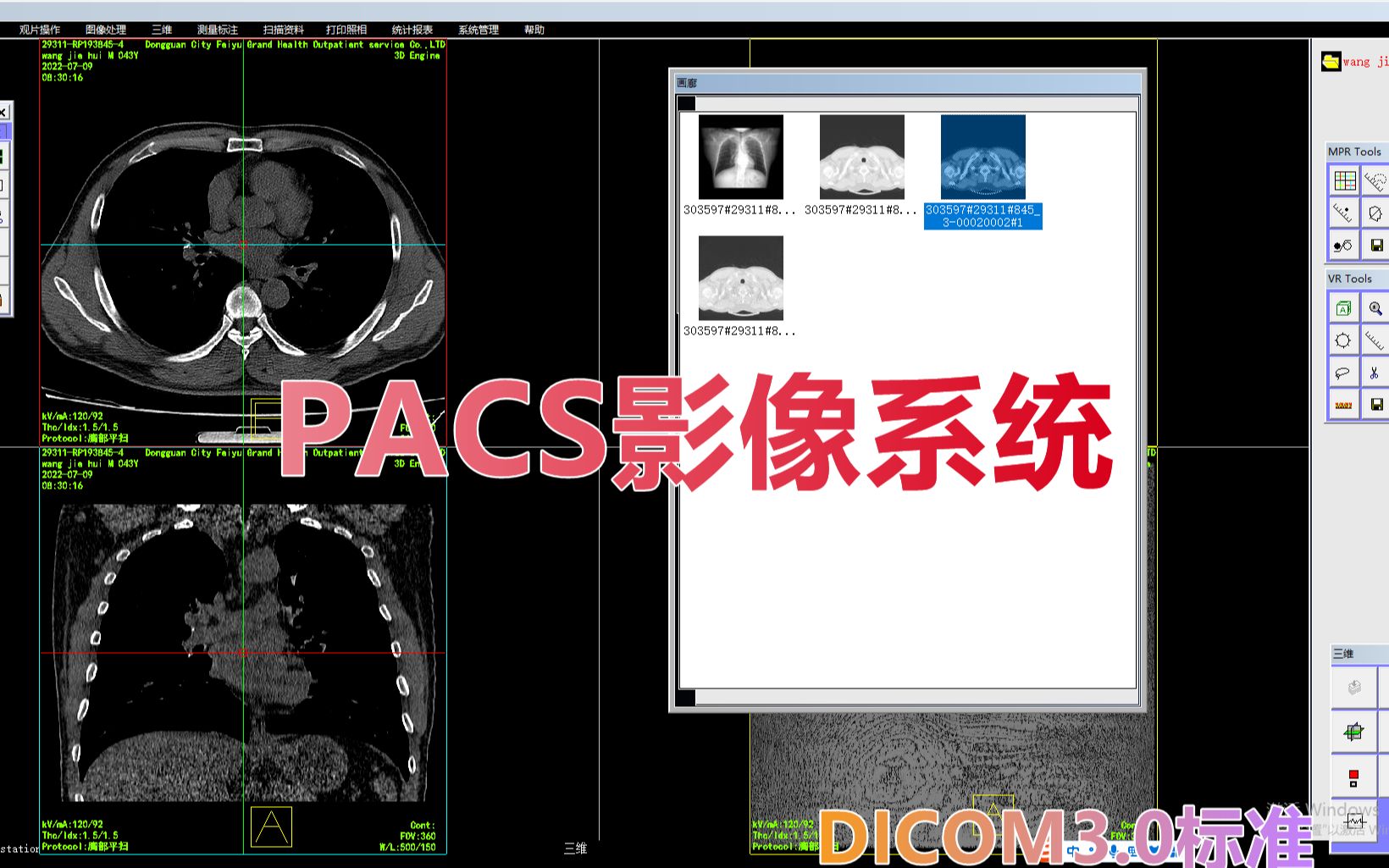 c 开发的一套医院用的pacs系统