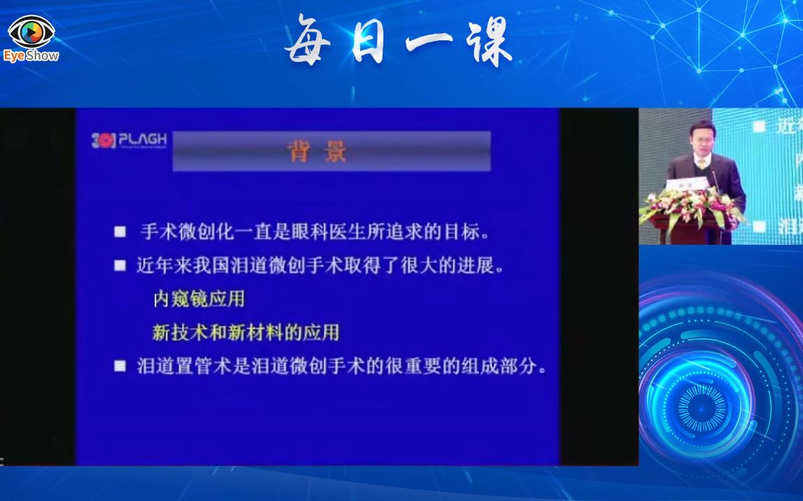 陶海《双泪小管置管术治疗泪道阻塞临床方案》解读哔哩哔哩bilibili