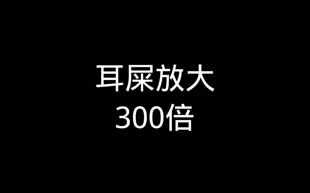 耳屎放大240倍!哔哩哔哩bilibili