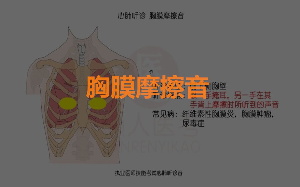 胸膜摩擦音 当胸膜面由于炎症而变得粗糙时,随着呼吸便可出现脏胸膜和壁胸膜间的摩擦声,即胸膜摩擦音.声音的性质差别很大,有的声音柔软细微,有的...