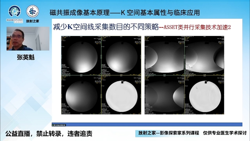 磁共振成像原理K空间哔哩哔哩bilibili