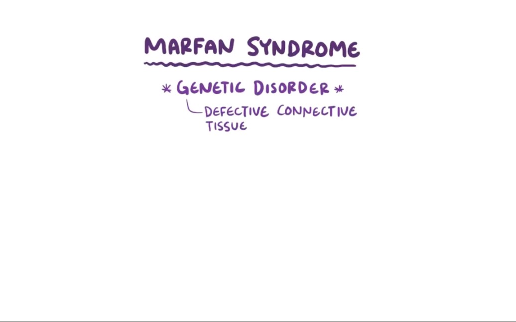 关于marfan syndrome(马凡综合征)的小知识哔哩哔哩bilibili