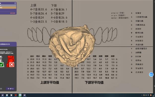 exocad数字化设计 马龙桥上部临时冠同步输出哔哩哔哩bilibili