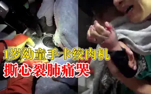 Descargar video: 1岁幼童手卡绞肉机撕心裂肺痛哭，消防紧急出动营救