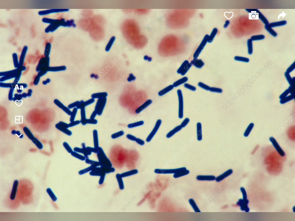 clostridium perfringens bacteria from wound