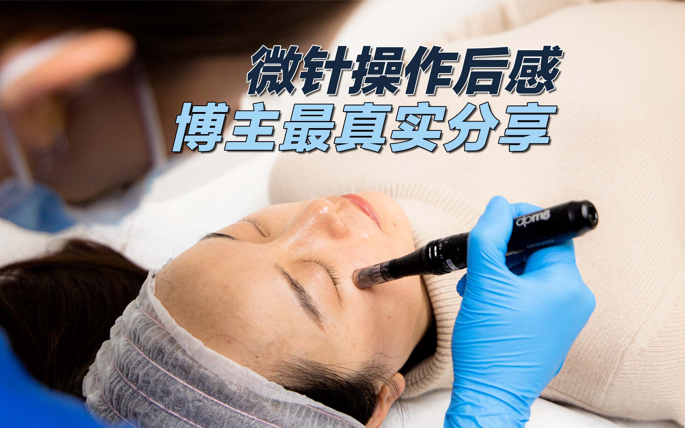 dermapen 微针 博主最真实体验|紧致澎弹,去印淡斑|伦敦|pulse light