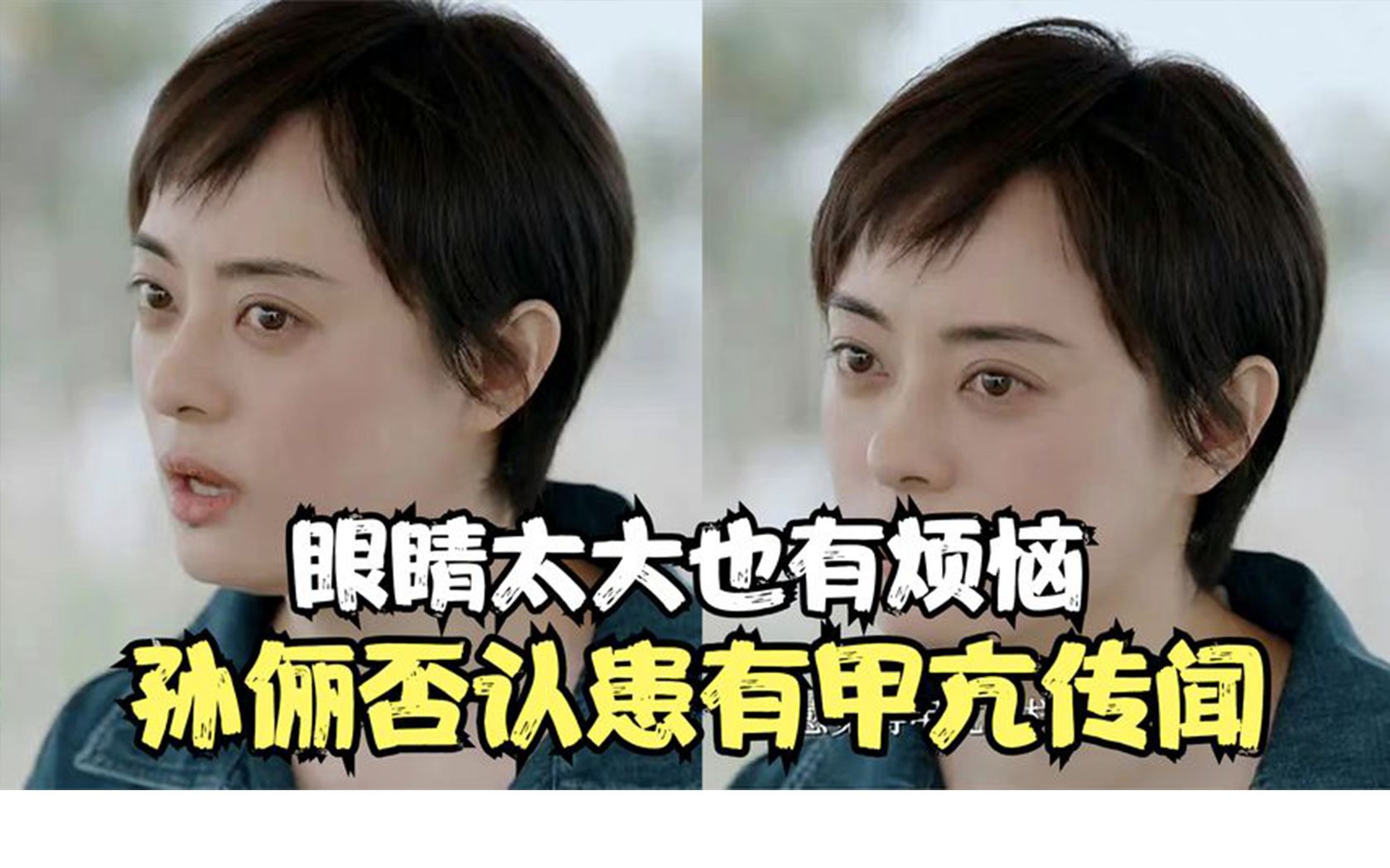 眼睛太大也是一种烦恼?孙俪否认患有甲亢传闻,医院检查没有问题