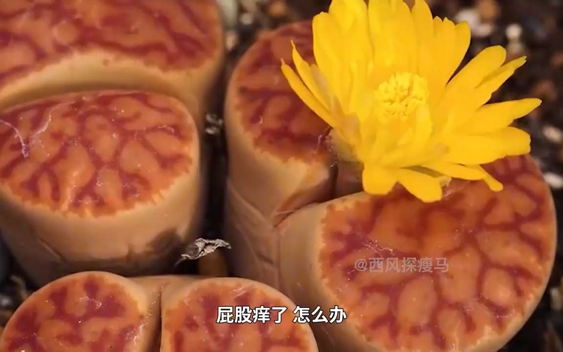 男子半夜屁股痒,肛门爬出10多条虫子,寄生虫蛲虫有多喜欢菊花?哔哩哔哩bilibili