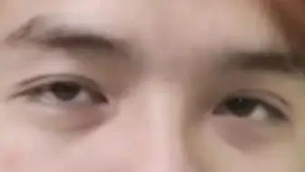秃眼看人黄