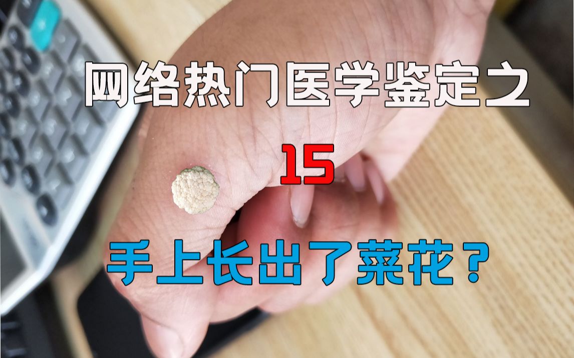 [图][医学鉴定]网络热门医学视频鉴定15