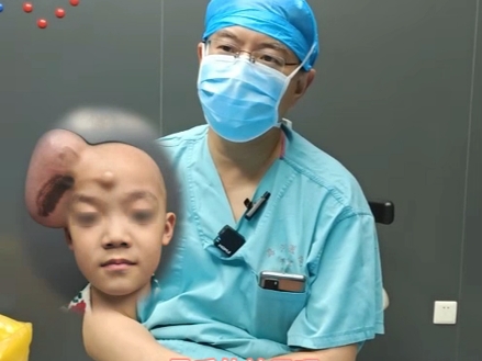 皮肤扩张治疗眉毛上沿中型黑痣 #科普 #正能量 #胎记