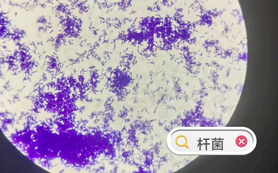 白喉杆菌显微镜镜下图图片