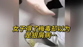 Download Video: 女子得了梅毒却以为是银屑病… 网友：一定要洁身自好，不然吃亏的是自己