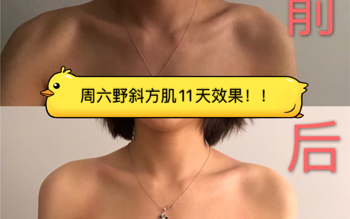 周六野斜方肌11天今天瘦腿真的很管用我准备把斜方肌当成每天必做身体