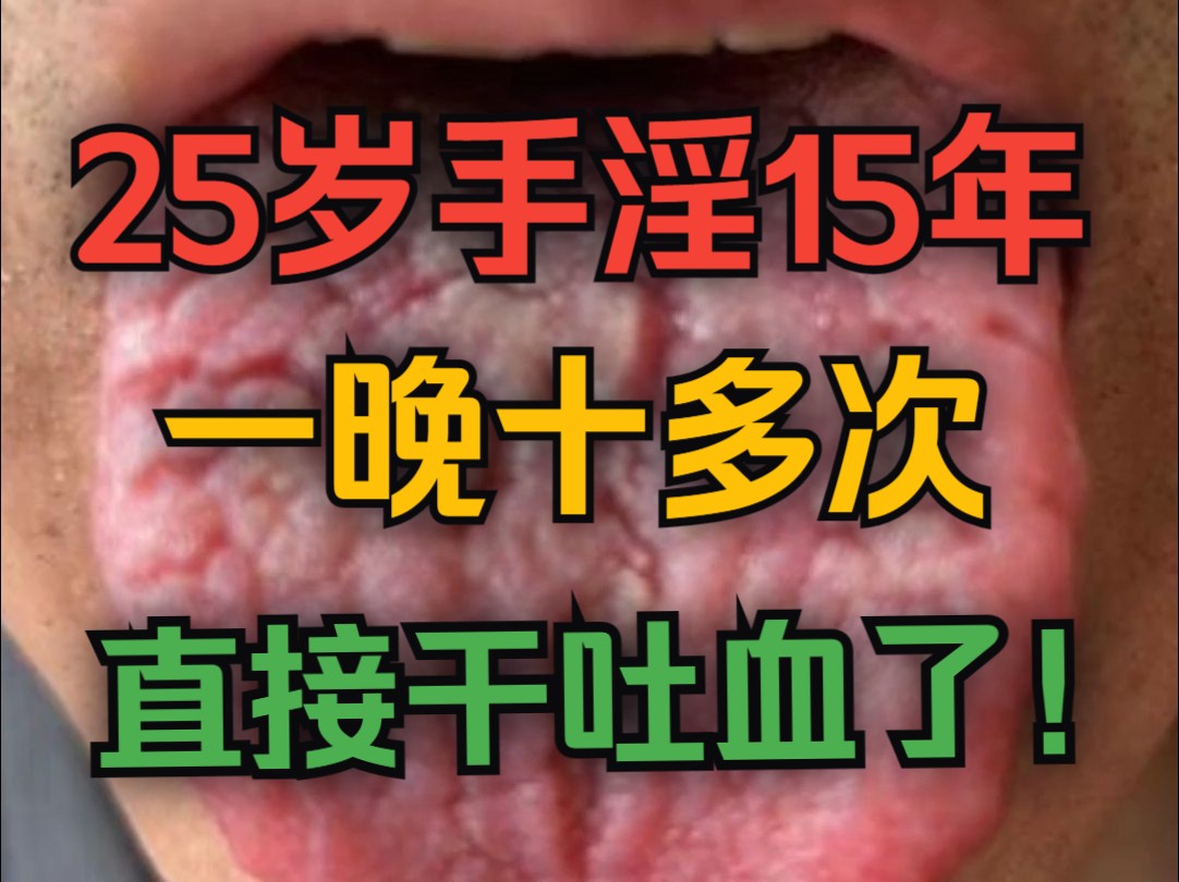 25岁小伙手淫15年,一晚10余次,直接吐血,大夫都无语了!哔哩哔哩bilibili