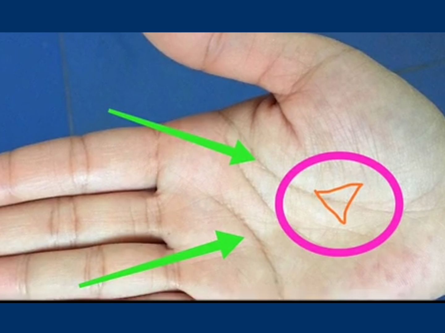 手中出现"三角纹"的手相