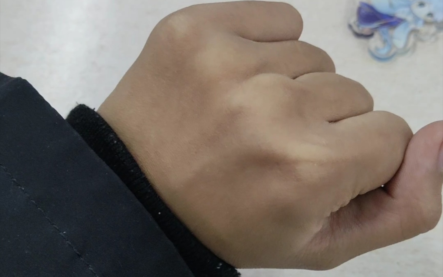 手筋会动是什么异能