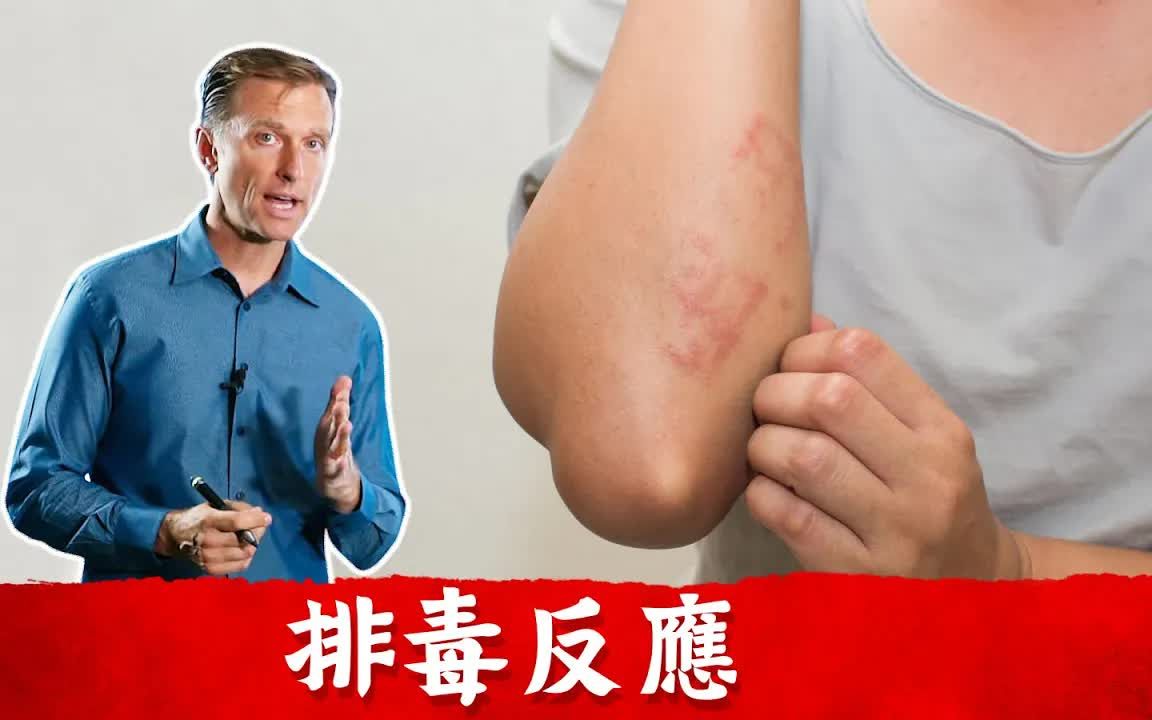 好转反应 (排毒反应),如何修复症状柏格医生 dr berg_哔哩哔哩_bili