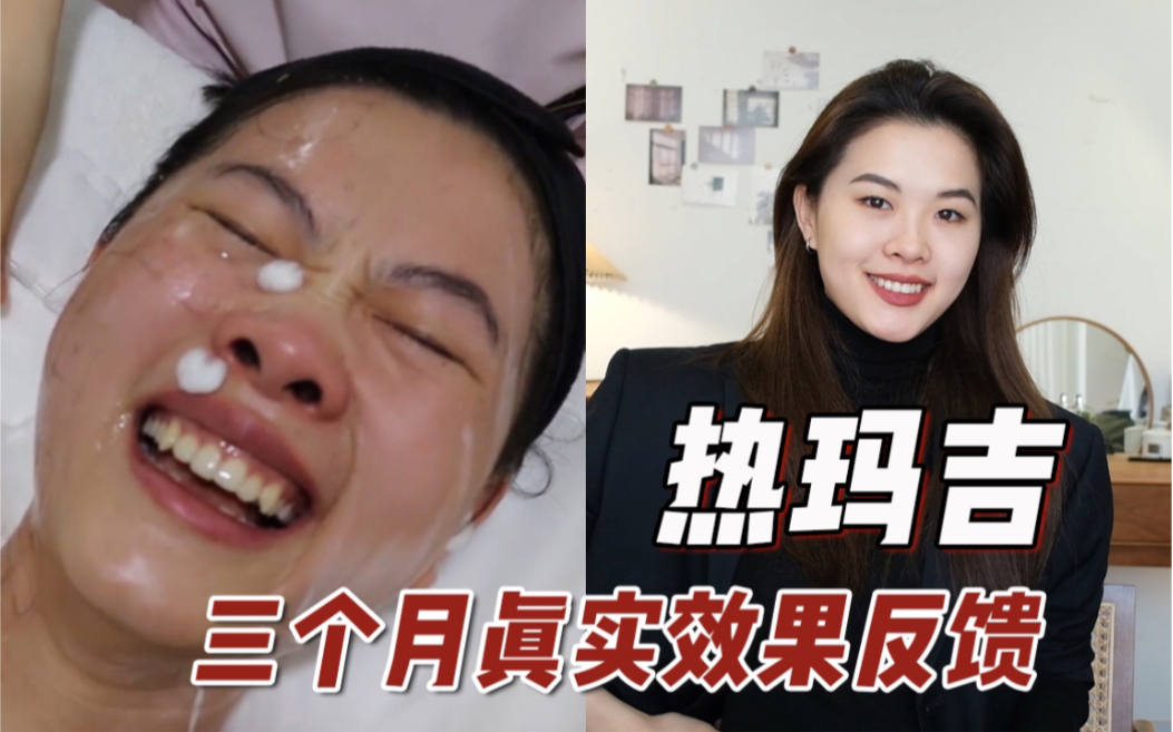 [图]三个月热玛吉真实效果反馈！2w贵妇医美真的值吗？干货心得都告诉你们~