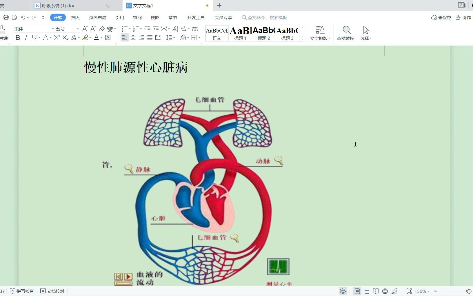 20min搞定内科学 呼吸系统疾病 慢性肺源性心脏病 精简总结_哔哩哔哩