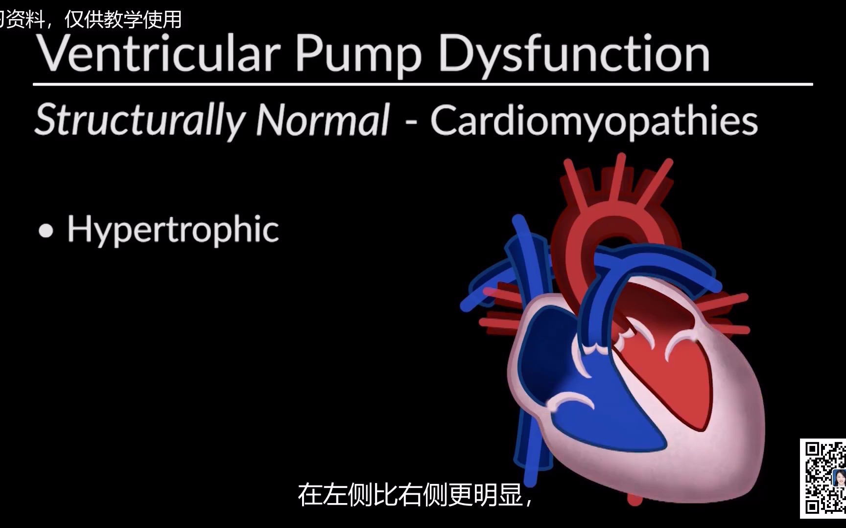 心力衰竭的病理生理学和诊断哔哩哔哩bilibili