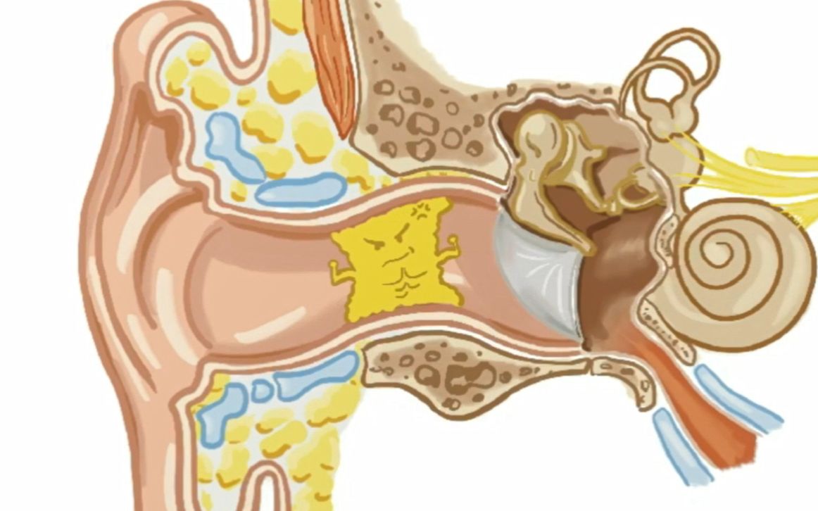 【科普视频】耵聍的叮咛 | 亿些做作配音哔哩哔哩bilibili