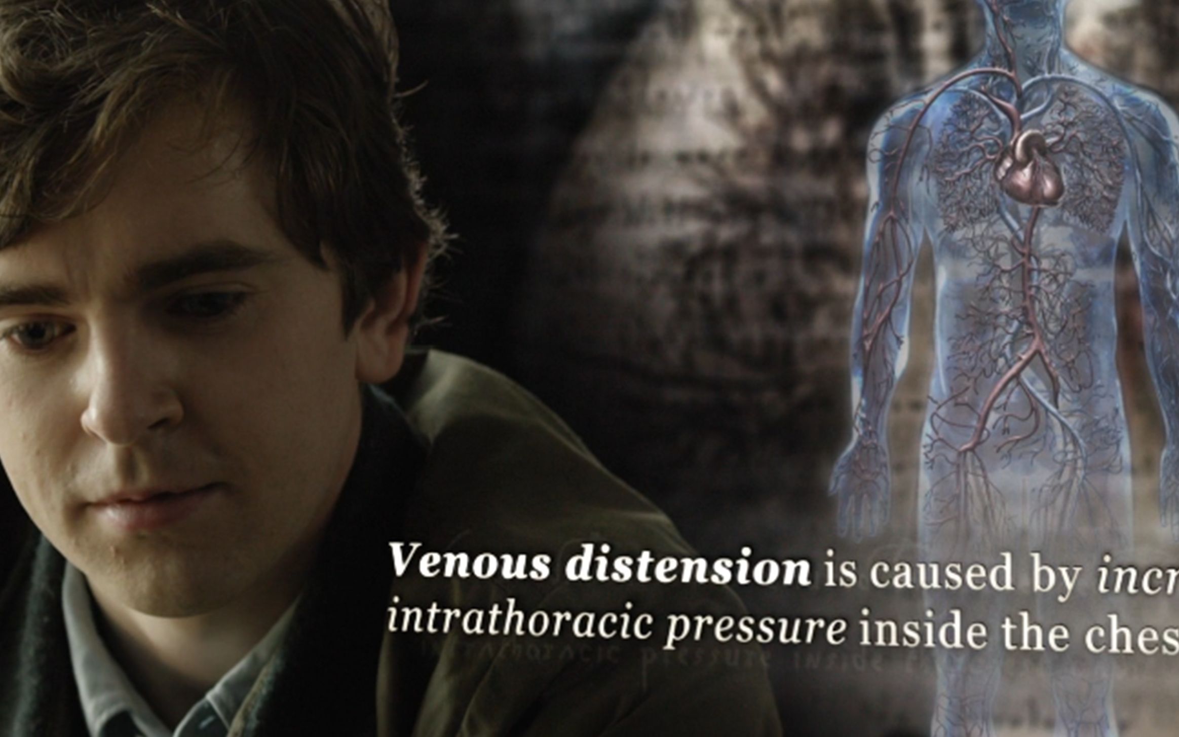 8岁男童被砸伤胸腔,死神肖恩首度登场,终将玻璃从心房取出_哔哩哔哩