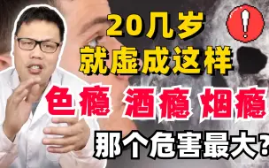 Download Video: 才20几岁，就虚成这样，色瘾、烟瘾、酒瘾，到底哪个危害最大？