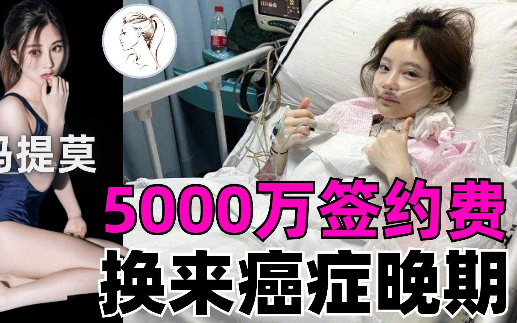 冯提莫自爆患癌原因:气的!5000万签约费的代价!她到底发生了什么,为何被禁?近况怎样?哔哩哔哩bilibili