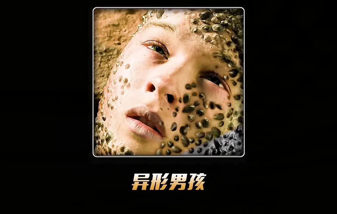 男孩全身被藤壶吸附,没想到第二天就发生诡异的事情