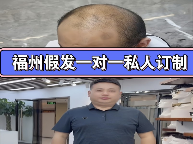 福州假发一对一私人订制哔哩哔哩bilibili