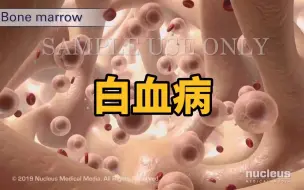 Download Video: 【3D医学动画】认识白血病！